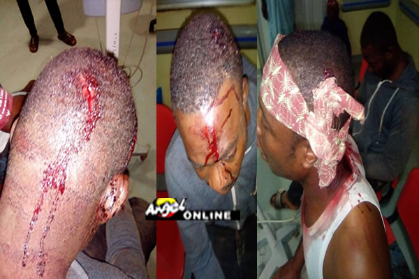 Tamale police attack