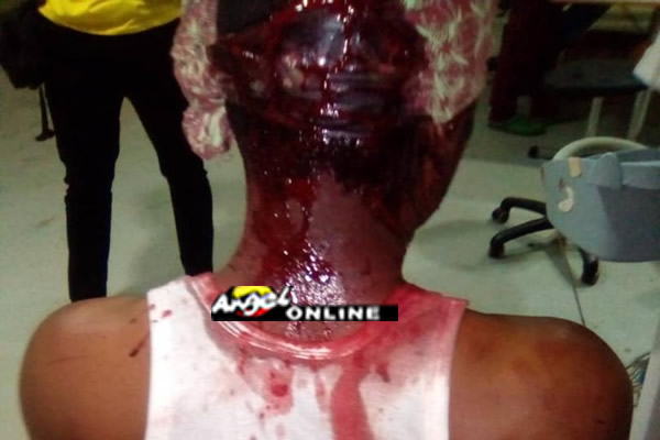 Tamale police attack