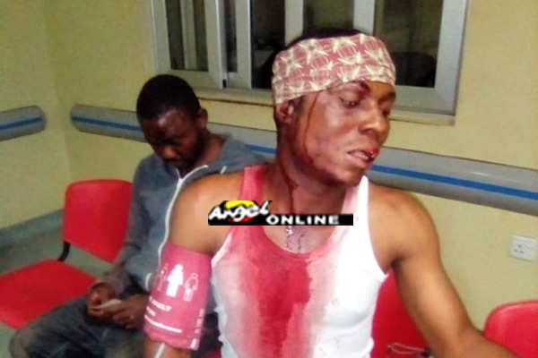 Tamale police attack