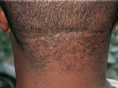 ‘Barber’s hand not good for my head’ is superstitious belief – Specialist
