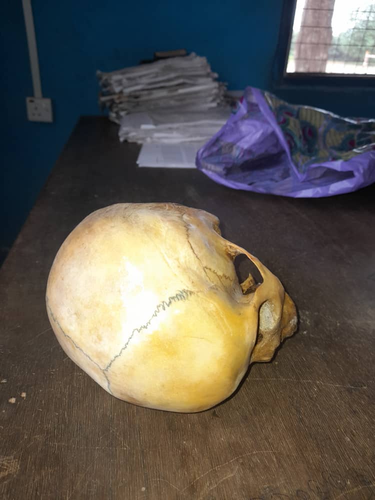 Assin Fosu human parts