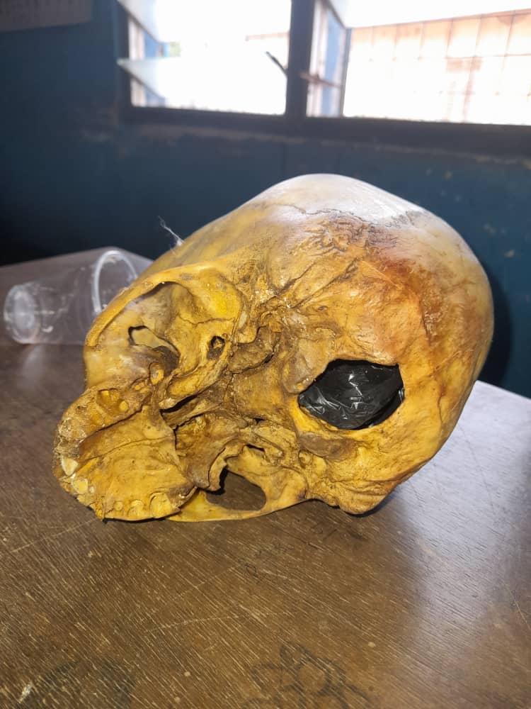 Assin Fosu human parts