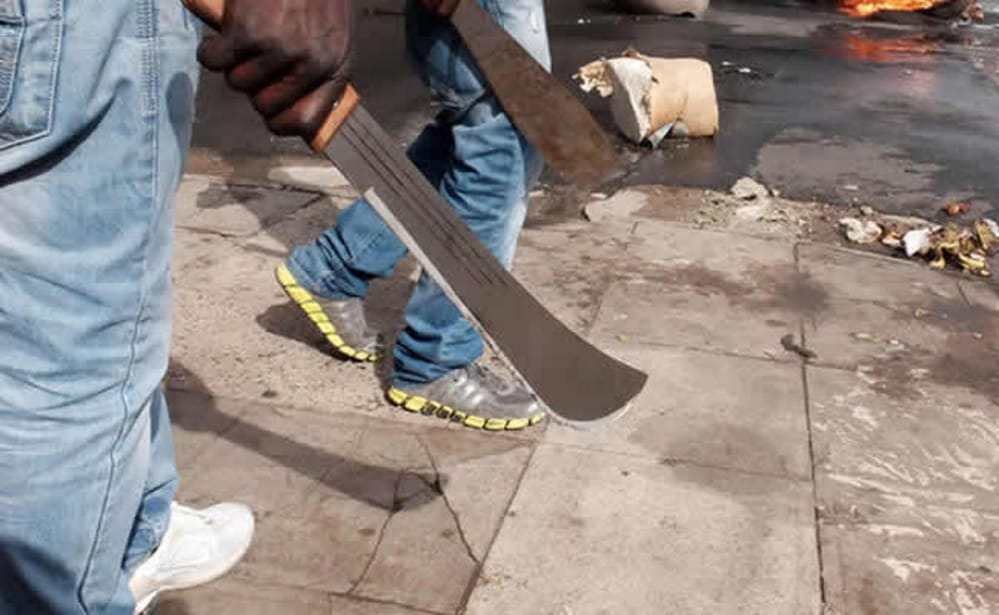 Awutu Senya: Fight over ¢400 leaves NDC youth organiser with deep cuts in the head