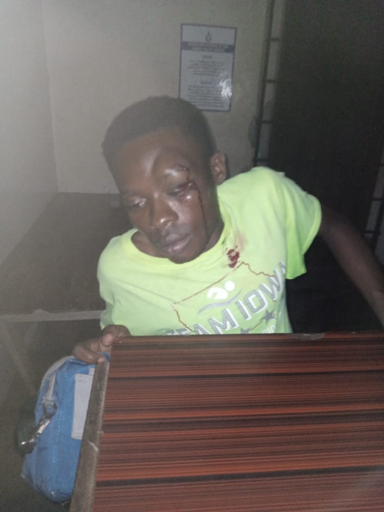 C/R: Physically challenged allegedly assaulted by police