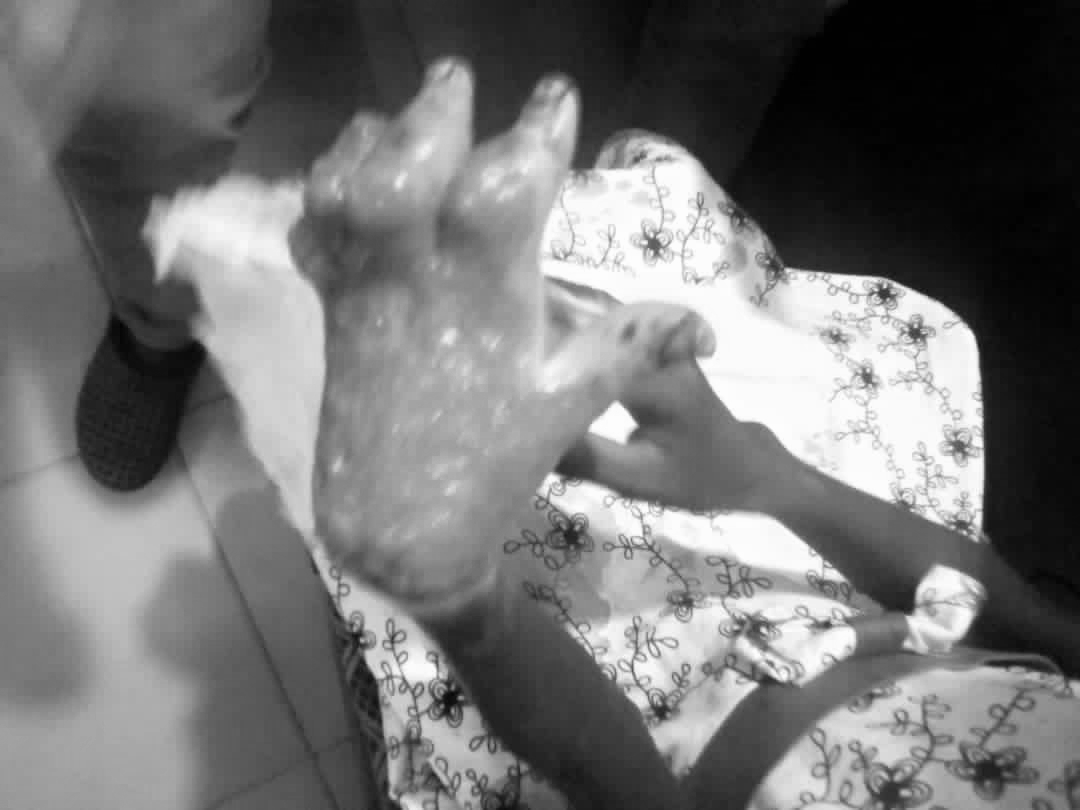 Female teacher arrested for ‘boiling’ hand of 9-yr-old girl who stole GHc2