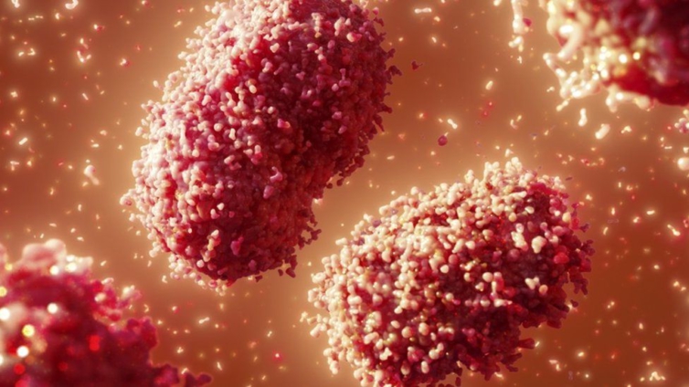 These are the facts about Monkeypox disease