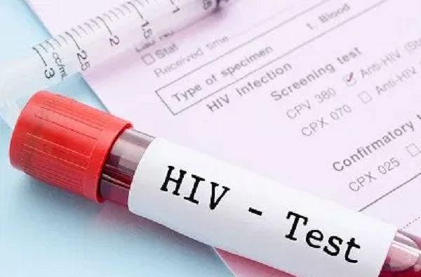 AIDS Commission’s plans to end AIDS by 2030 in spate