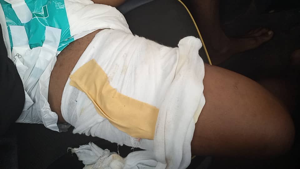 Krobo power clash: Victim discharges himself from hospital for fear of amputation