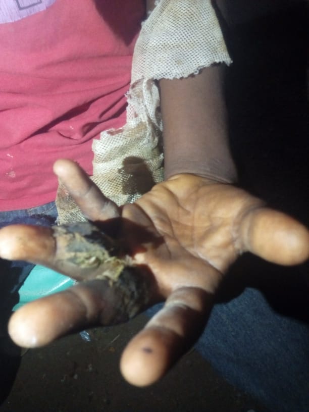 Businessman ‘chops’ hand of10-year-old for stealing scraps