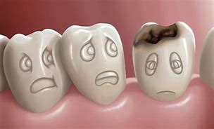 Belinda Ansonmaa writes: Four home remedies suitable for tooth decay