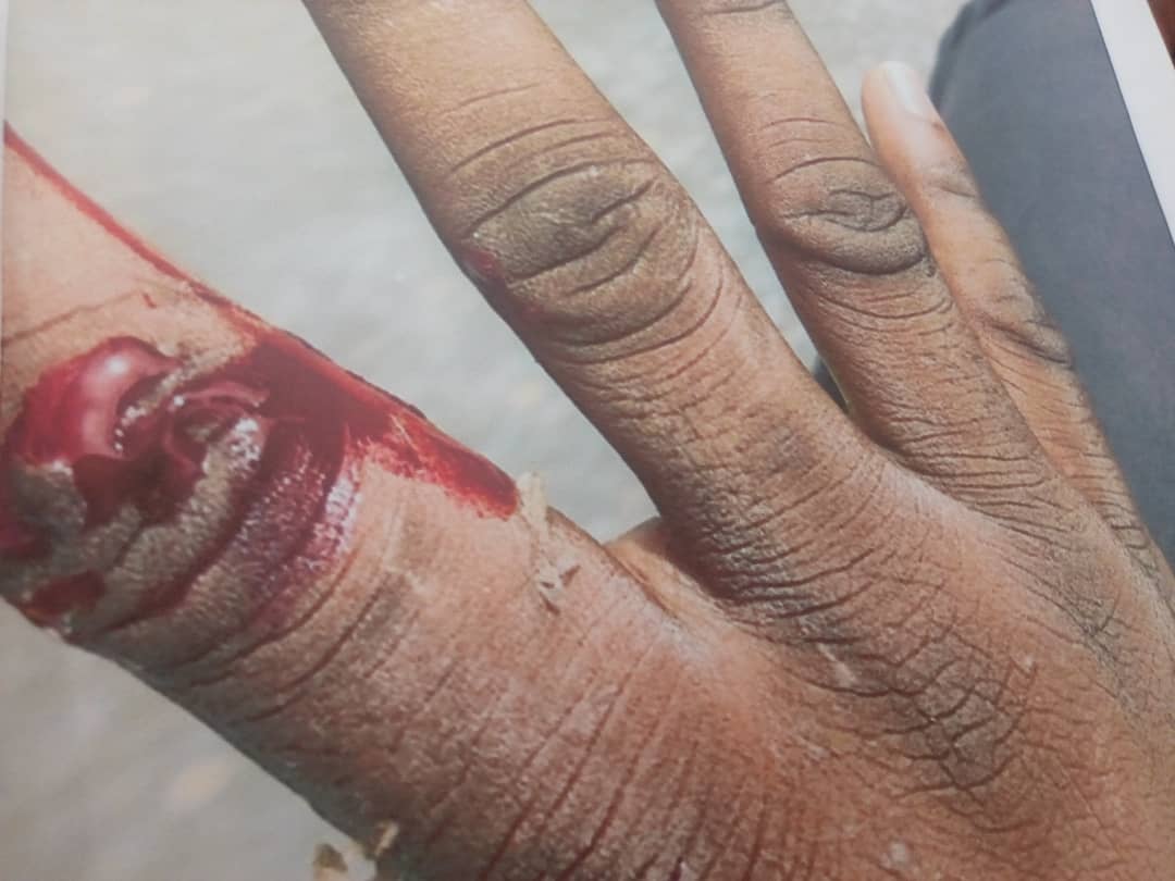 Assin Fosu police finger