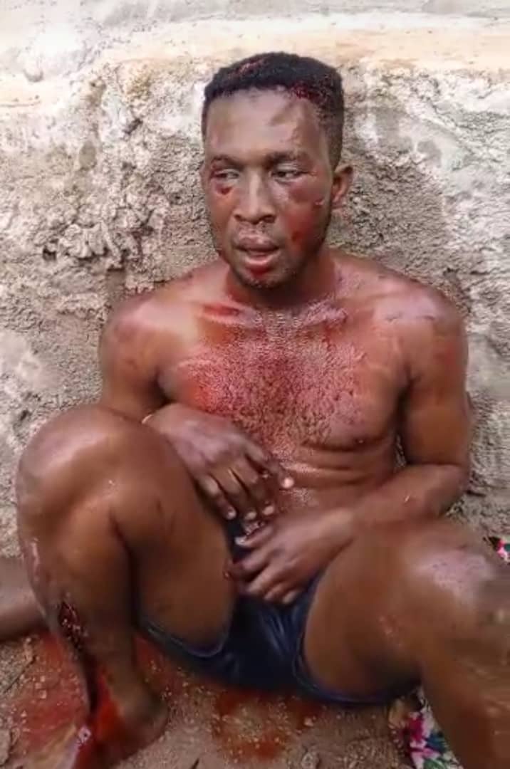 Mortitian burnt alive over alledged ritual murder