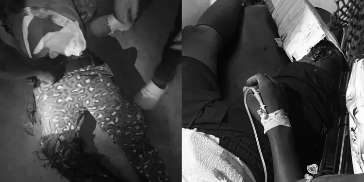 Two Immigration Officers shot at Nagani by unknown gunmen