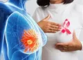 Breast screening included in Free Primary Healthcare package – NHIA