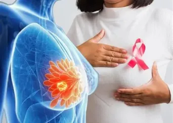 Breast screening included in Free Primary Healthcare package – NHIA