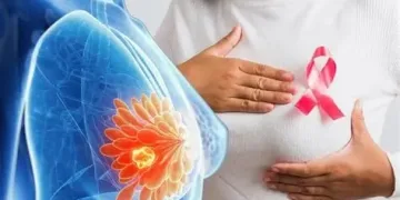 Breast screening included in Free Primary Healthcare package – NHIA