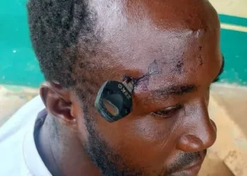 Okada rider struck with motorcycle key in the head while separating a fight