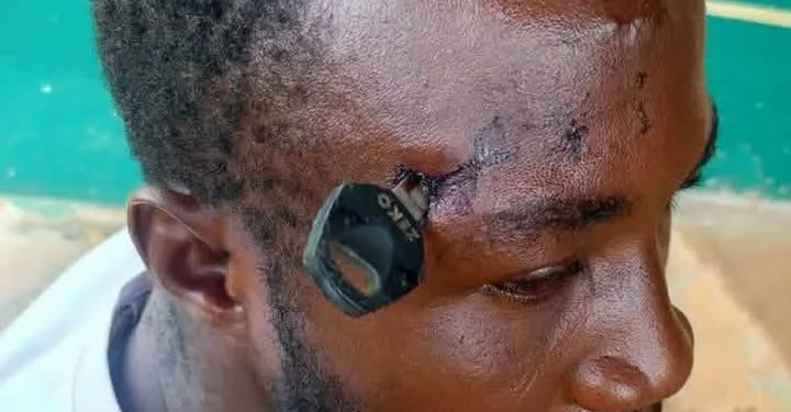 Okada rider struck with motorcycle key in the head while separating a fight
