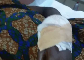 JHS girl cuts schoolmate with cutlass over alleged breast touching